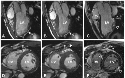 Scientists conducted world's first patient-based cardiac MRI study