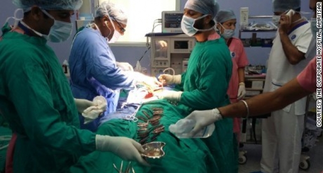 В Индии хирурги вынули из желудка мужчины 40 ножей