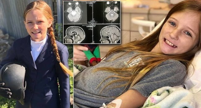 Medical mystery: 11-year-old's brain tumor disappears