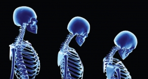 26 октября в Ереване пройдет крупная международная конференция по остеопорозу