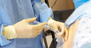 5 myths about epidural anaesthesia