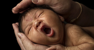 В Индии врачи обнаружили в желудке у младенца развивающийся эмбрион