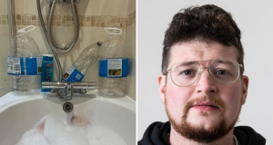 British man suffers from itching for long time because of tap water