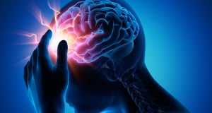 Գիտնականներին հաջողվել է վերականգնել կաթվածով հիվանդների ձեռքերի աշխատանքը` ուղեղի խթանման նոր մեթոդի շնորհիվ