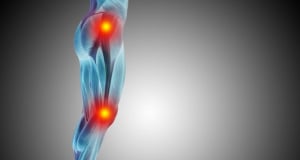 The Lancet: Drug discovered that prevents rheumatoid arthritis