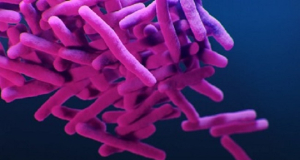 В городе Лонг-Бич в Калифорнии сложилась  чрезвычайная ситуация из-за вспышки туберкулеза