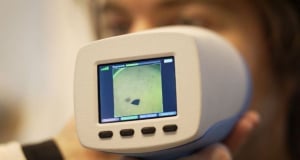 В Латвии тестируют устройство, которое позволяет спасти больных меланомой