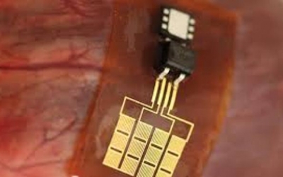 Flexible device for creating electrical source in the body | NEWS.am ...