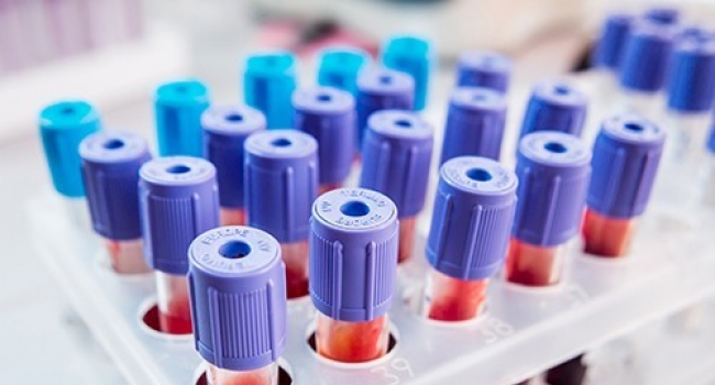 Создан эффективный тест крови на рак яичников