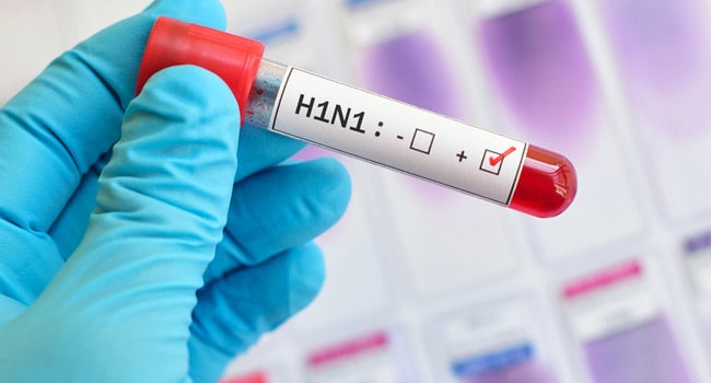 H1N1 գրիպից մահացած պացիենտը 39 տարեկան կին էր. նա հիվանդ է եղել 10 օրից ավելի