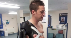 Soldier wounded in Afganistan becomes first Briton to have bionic arm, which is controlled with his BRAIN