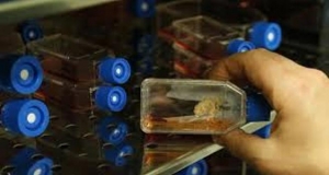Belgian doctors repair bones using stem cells