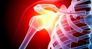 Shoulder dislocation: What you need to know