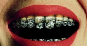 Опасно ли курение для наших зубов и десен?
