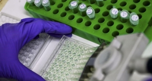 İsrail’li bilim adamları melanomanın yayılmasını önleyen bir vasıta keşfettiler