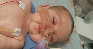 Благодаря решению ЕСПЧ смертельно больной британский малыш попробует экспериментальное лечение в США