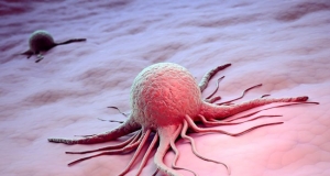 5 հետաքրքիր փաստ քաղցկեղի մասին, որ պետք է բոլորն իմանան