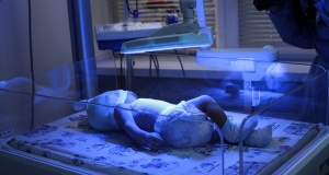 «Սլավմեդ» ԲԿ-ում փրկել են ծայրահեղ ծանր վիճակում ծնված նորածնի կյանքը (ֆոտո)