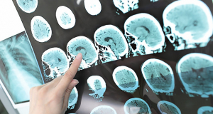 Pessimism originates in the brain, and scientists now know exactly where