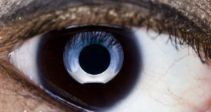 Dublin mum blind in one eye after parasite burrowed its way in as she showered