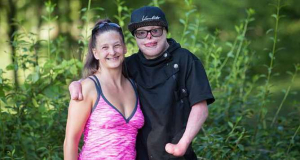 Teenager who felt 'like a monster' after suffering 95% burns to his body finally embraces his disfigured body