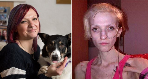 30-летняя женщина с диабетом чуть не умерла после отказа от инсулина из-за желания похудеть (фото, видео)