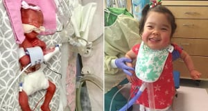 Preemie born more than 3 YEARS ago has gone home from hospital at last after countless surgeries to fix her heart and lungs