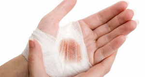Chinese scientists improve the performance of wound dressings