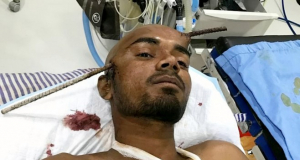 Construction worker survives iron rod through the head