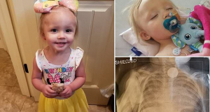 Toddler 'left vomiting black gunk' after swallowing a BATTERY meant for her father's watch that burned through her oesophagus and saw her spend a week in intensive care