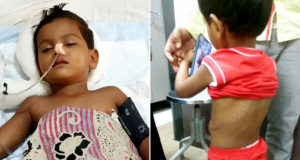 Child miraculously survives being impaled after falling off building