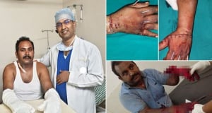 Surgeons sew man's hands chopped off during street fight