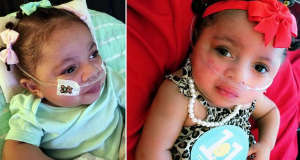 Girl with rare heart defect survives after disconnecting from life support device