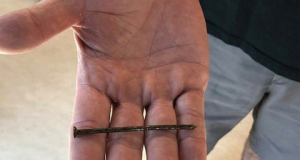 Man survives after nail thrust into his heart