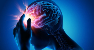 What are 5 early signs of stroke that everyone should know about?