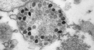 Для кого омикрон-штамм коронавируса не опасен?