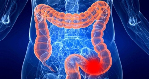 What signs could indicate colorectal cancer?