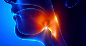 Do tonsils absorb nanoplastic?