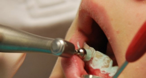 Необходимы ли опиоиды для лечения зубной боли?