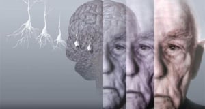 Cases of dementia expected to double by 2050 - Alzheimer’s Care Armenia