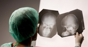 Как влияют повторные травмы головы на состояние черепа?