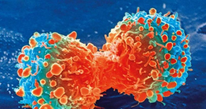 Գիտնականները թեստ են մշակել, որը կարող է իմունոթերապիայի միջոցով կանխատեսել քաղցկեղի կրկնության հավանականությունը