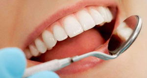 Ученые усовершенствовали  минерализированный материал, способный восстановить зубную эмаль