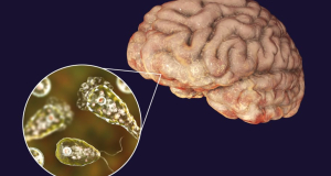 US: Boy dies from rare brain-eating amoeba