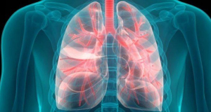 52-ամյա տղամարդու մեջքի ցավի պատճառը թոքերի քաղցկեղն էր