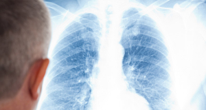 Как распознать ковидную пневмонию