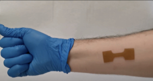 Programmable 3D printed wound dressing could improve treatment for burn, cancer patients