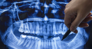 The first drug that regrows teeth is about to enter clinical trials

 