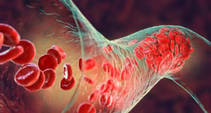 Researchers discover possible signs of hypertension