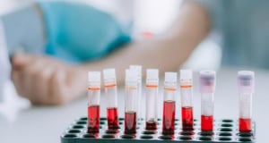 Blood test can determine who is at risk of developing multiple sclerosis - scientists
